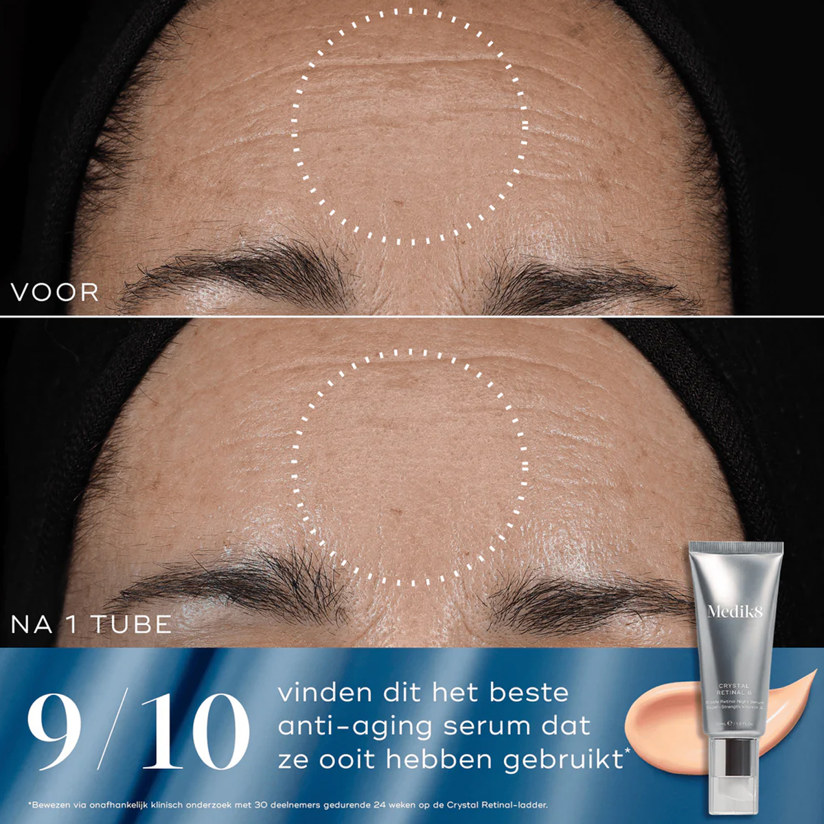 Medik8 - Rejuvenation Reset - Kit 5