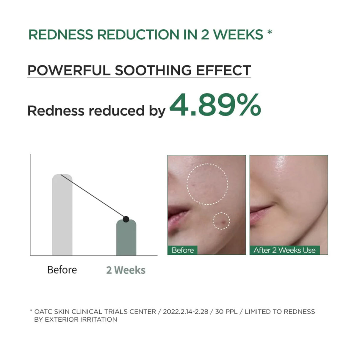 Anua - Heartleaf 80% Soothing Ampoule - 30 ml 7