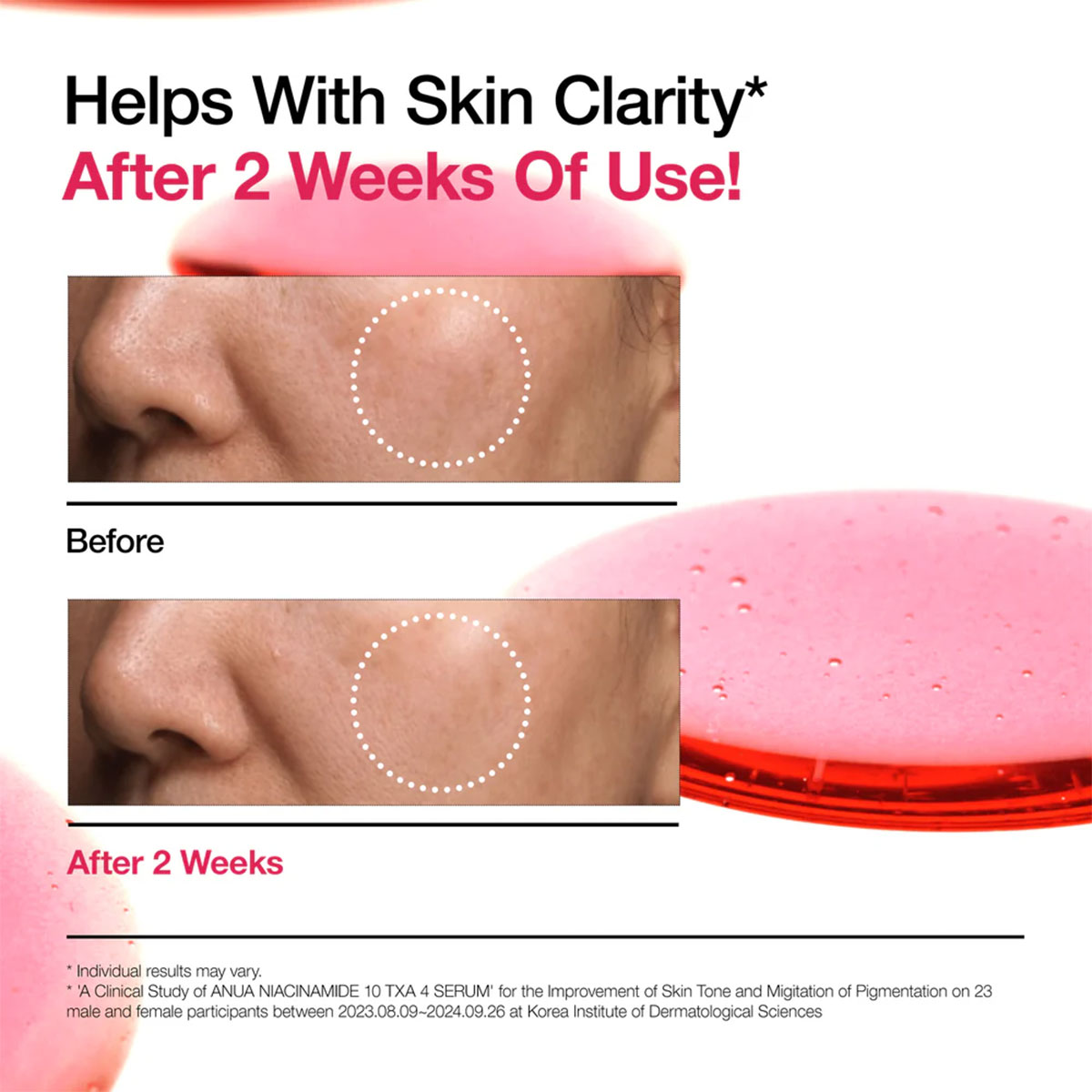 Anua - Niacinamide 10% + Txa Serum - 30 ml 8