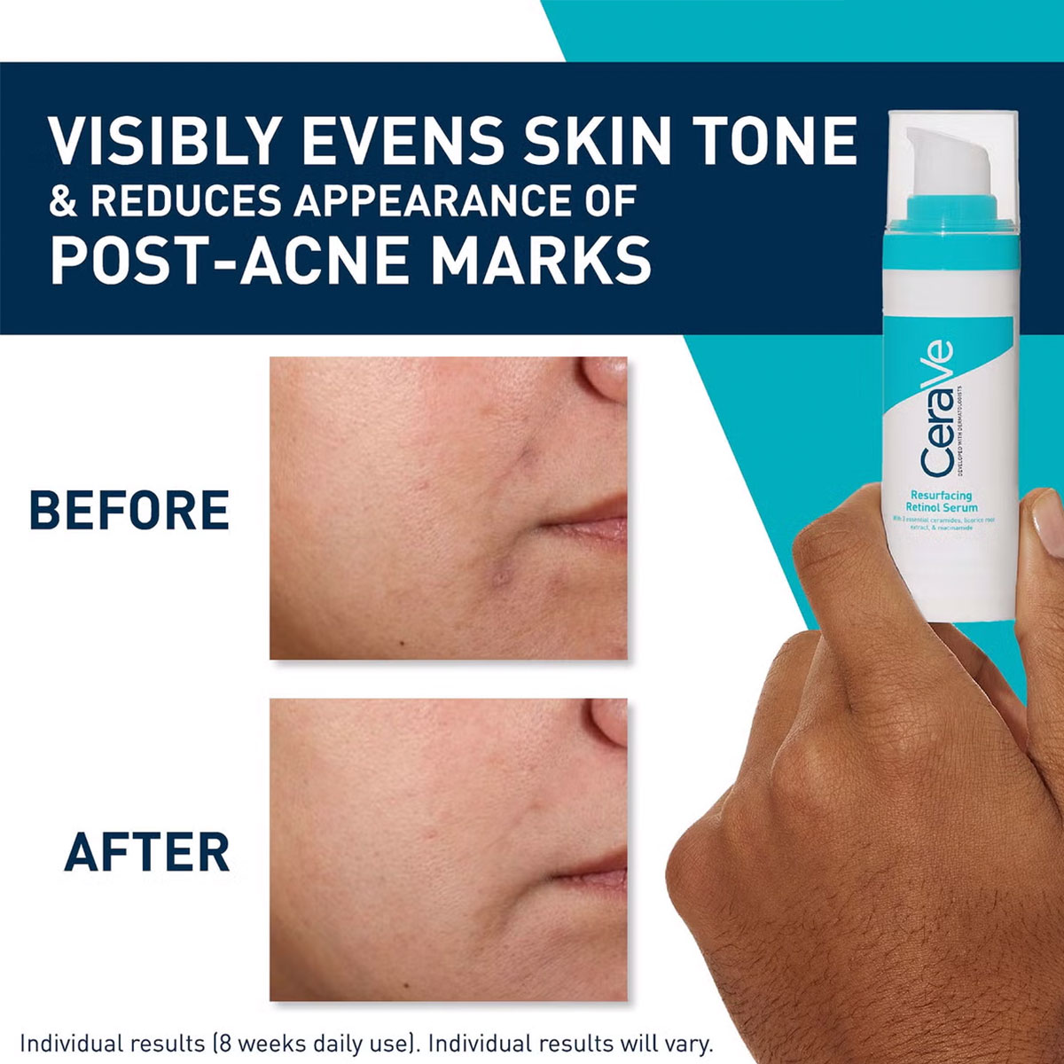 CeraVe - Retinol Serum Anti-Onzuiverheden - 30 ml 4