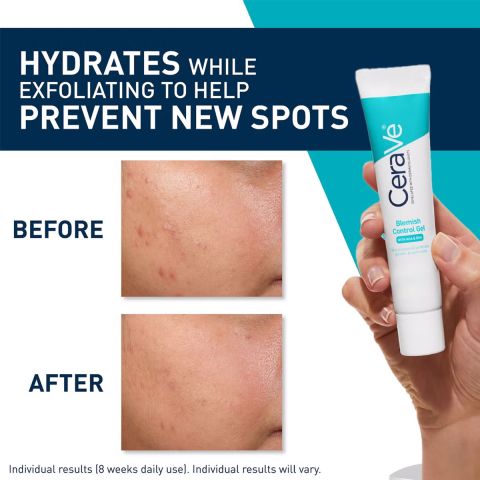 CeraVe - Geconcentreerde Anti-Onzuiverheden Verzorging Tube - 40 ml