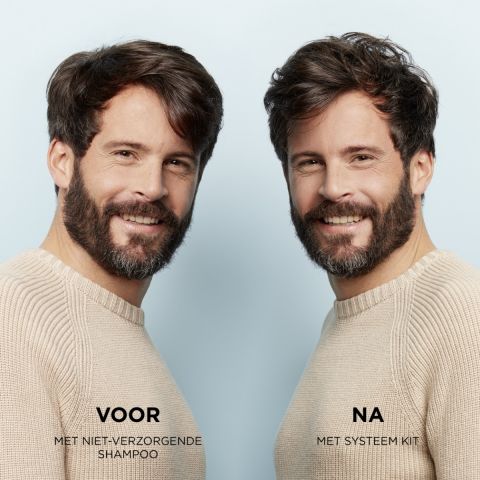 Nioxin - System 2 - Voordeelset