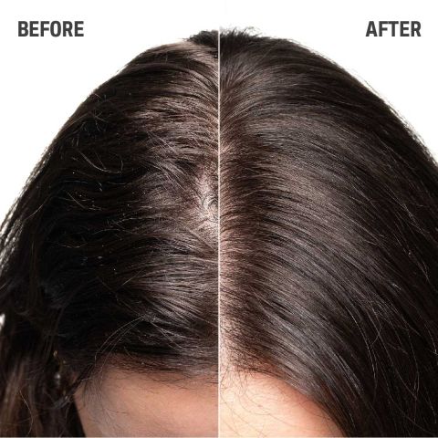 Goldwell - Dualsenses Scalp Specialist - Sensitive Foam Shampoo - 250 ml