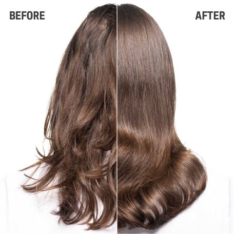 Goldwell - Dualsenses Scalp Specialist - Anti-Dandruff Shampoo - 250 ml