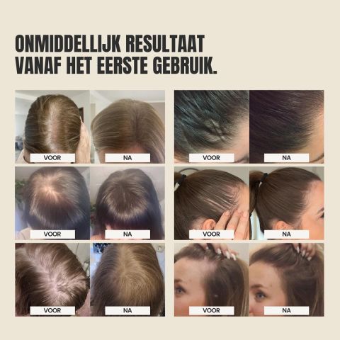 IMPERIO - Uitgroeipoeder