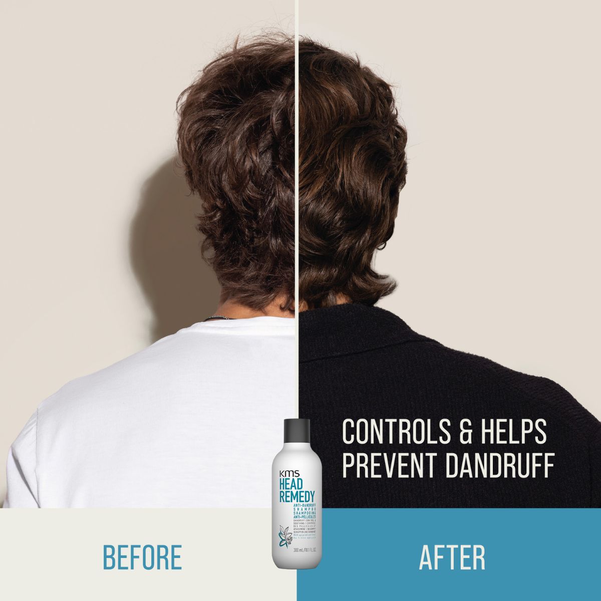 KMS - HeadRemedy Anti-Dandruff Shampoo - 300 ml 6