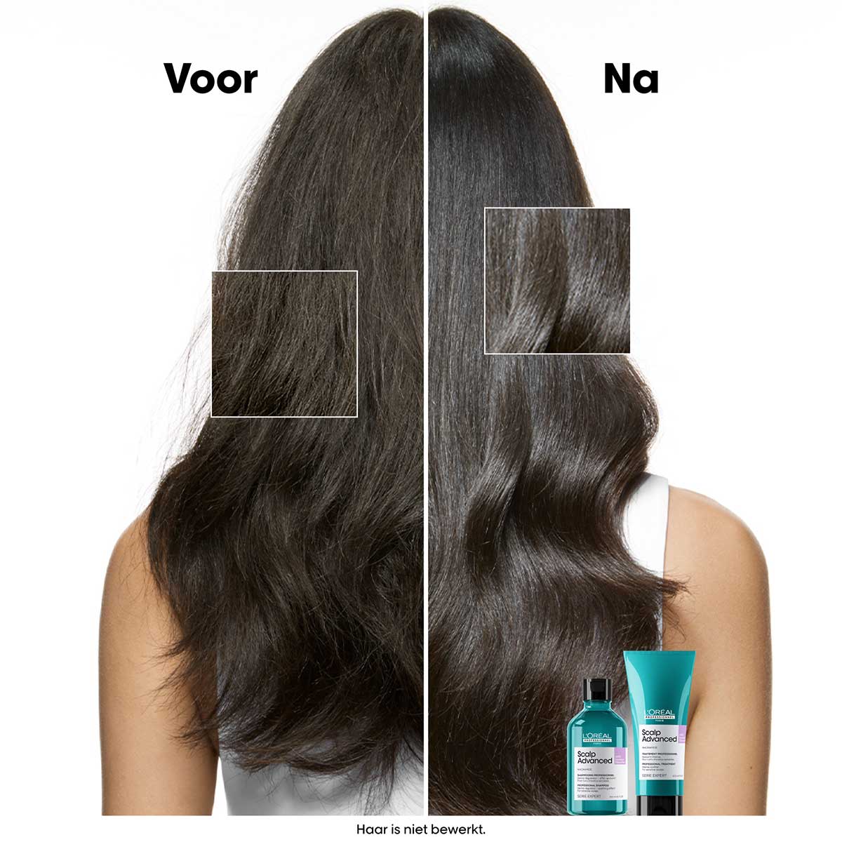 L'Oréal Professionnel - Scalp Advanced Anti-Discomfort Shampoo Refill voor de gevoelige hoofdhuid - 500 ml 4