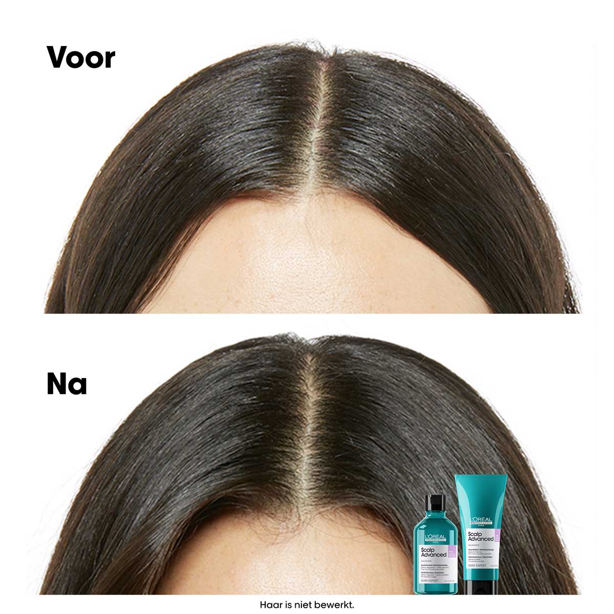L'Oréal Professionnel - Scalp Advanced Anti-Discomfort Shampoo Refill voor de gevoelige hoofdhuid - 500 ml 5