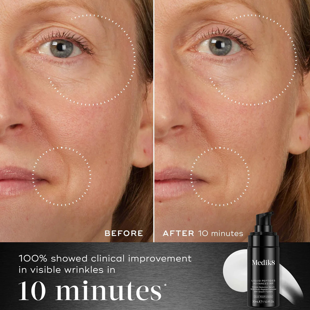 Medik8 - Liquid Peptides Advanced MP - 30ml 5