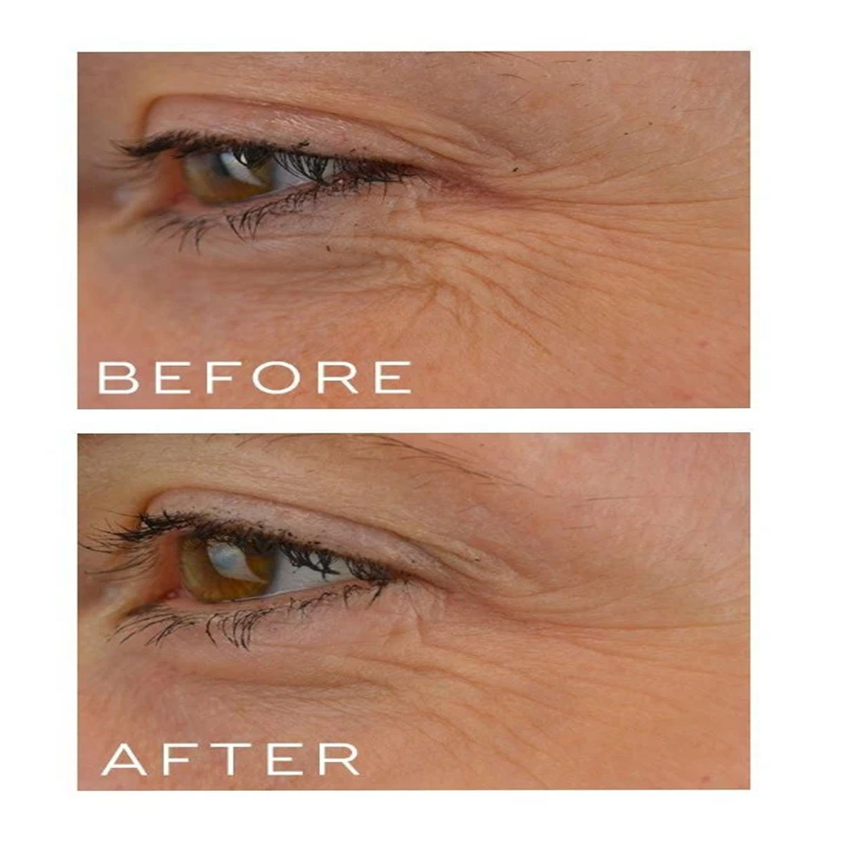 Medik8 - Crystal Retinal 10 - 30 ml 2