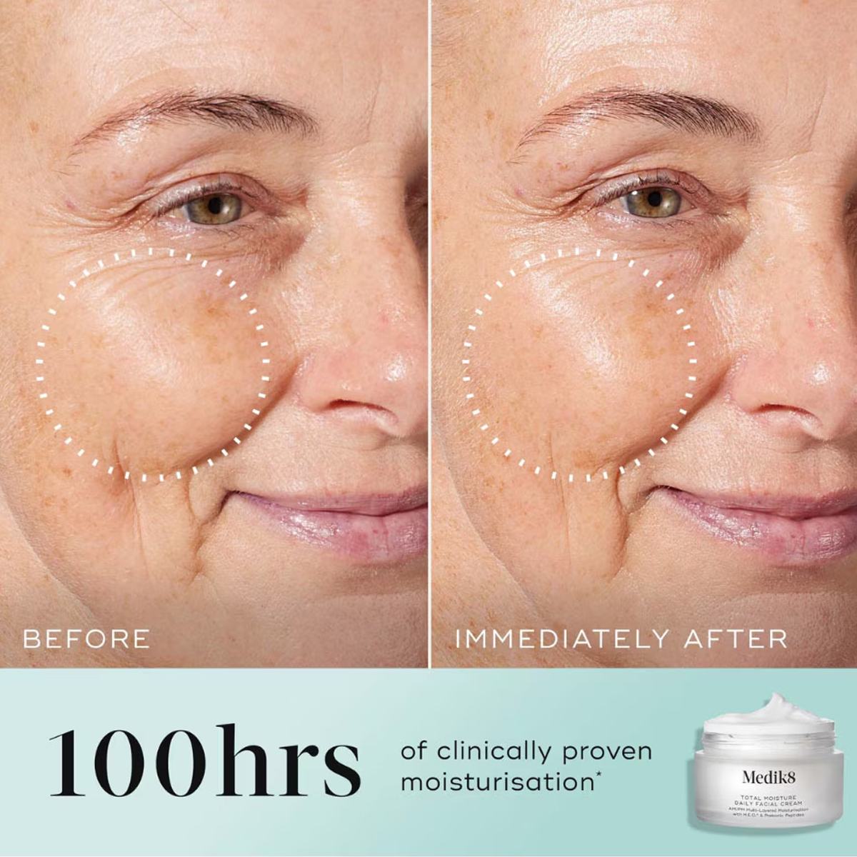 Medik8 - Total Moisture Facial Cream Refill - 50 ml 4