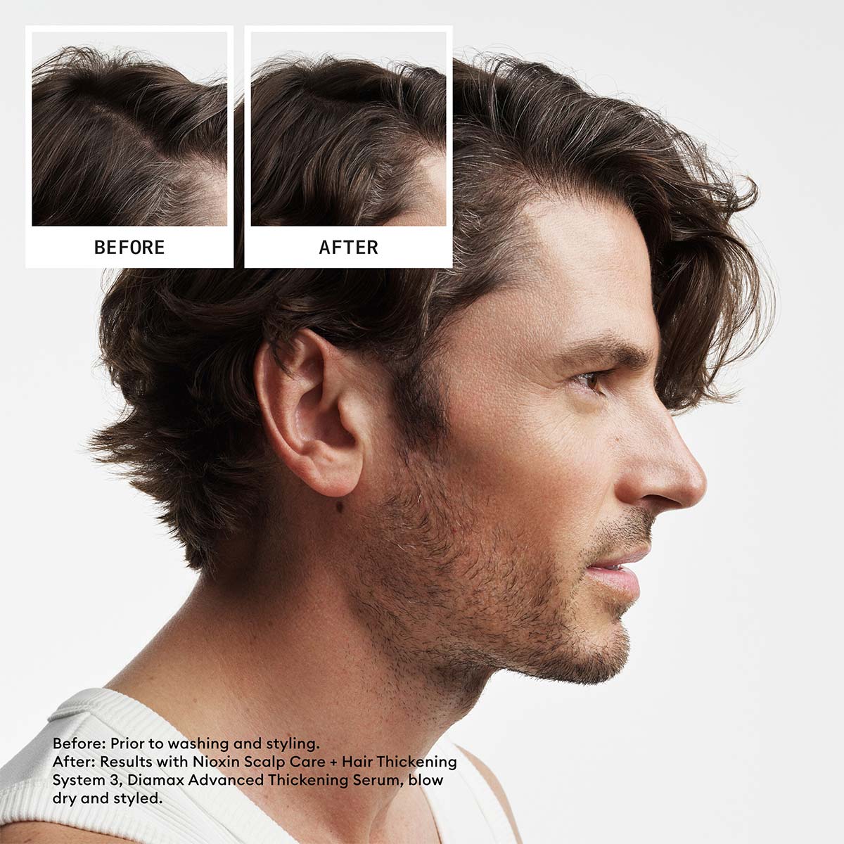 NIOXIN - System 2 Loyalty Kit 4