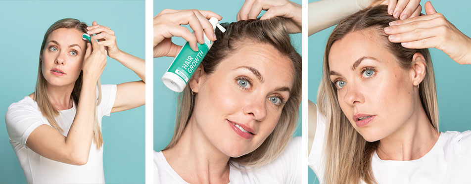 Neofollics-Hair-Growth-Producten